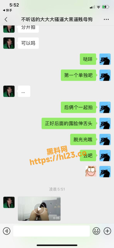 400X866