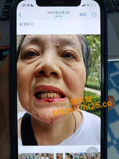 400X533
