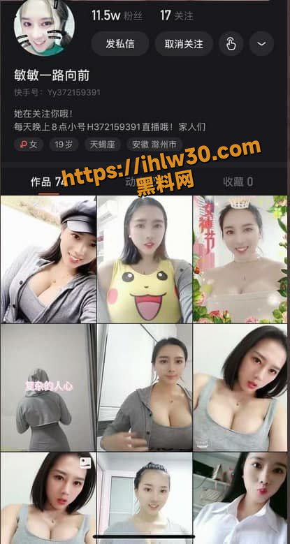 415X779