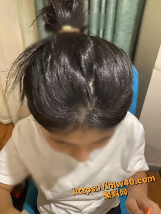 541X720