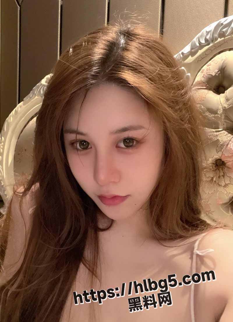 102