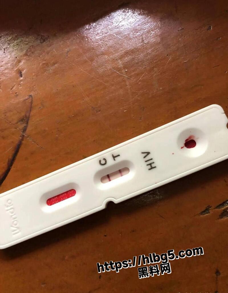 814