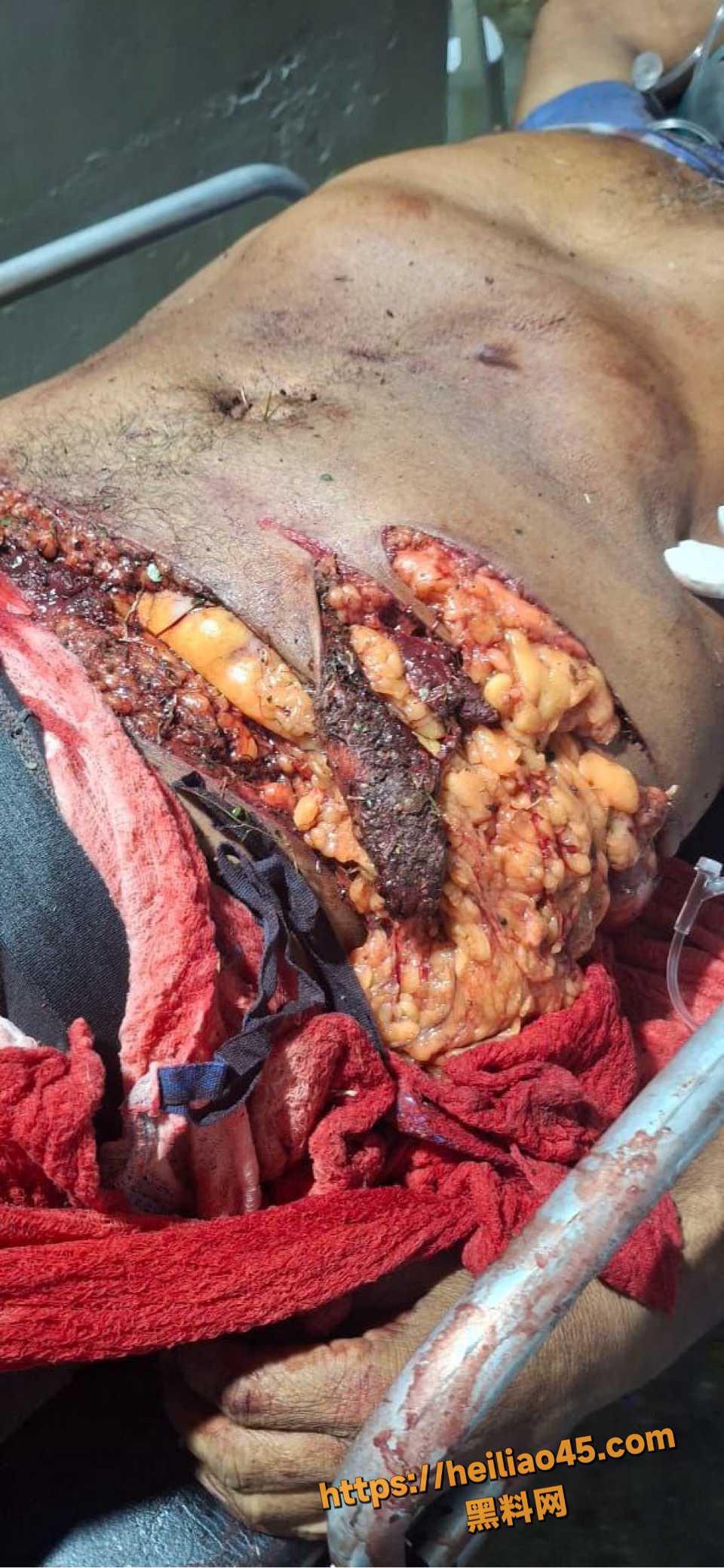 血腥8