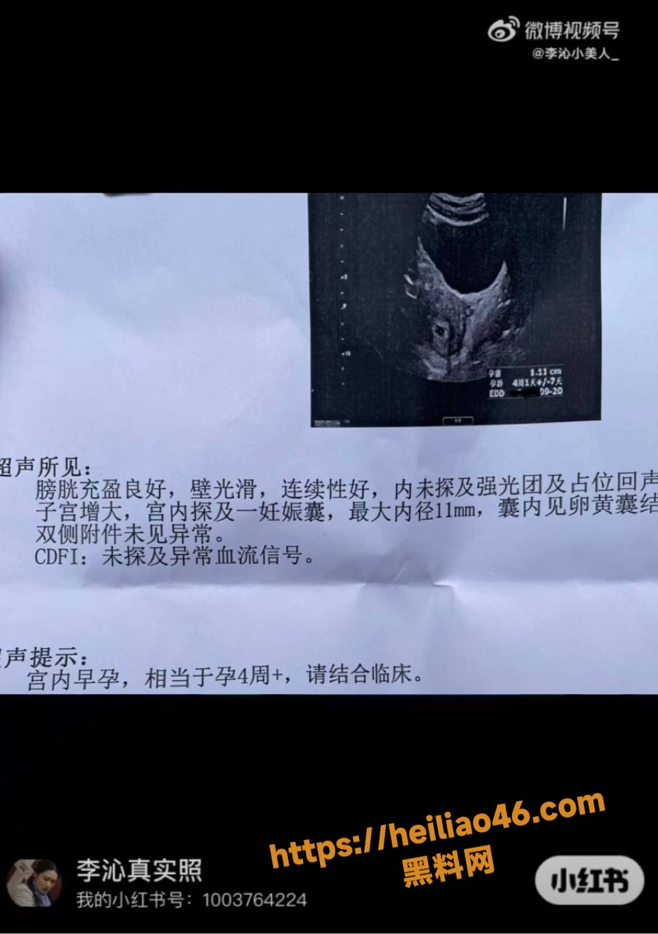 李沁与雷军不正当关系9