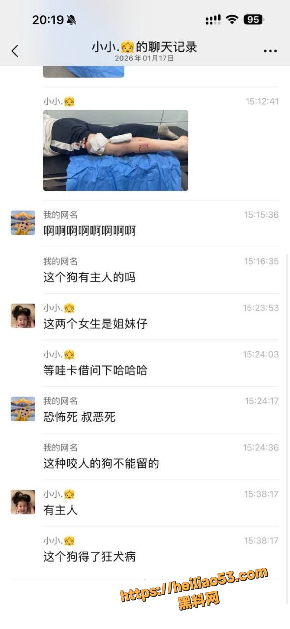 姐妹被疯狗追咬事件曝光6
