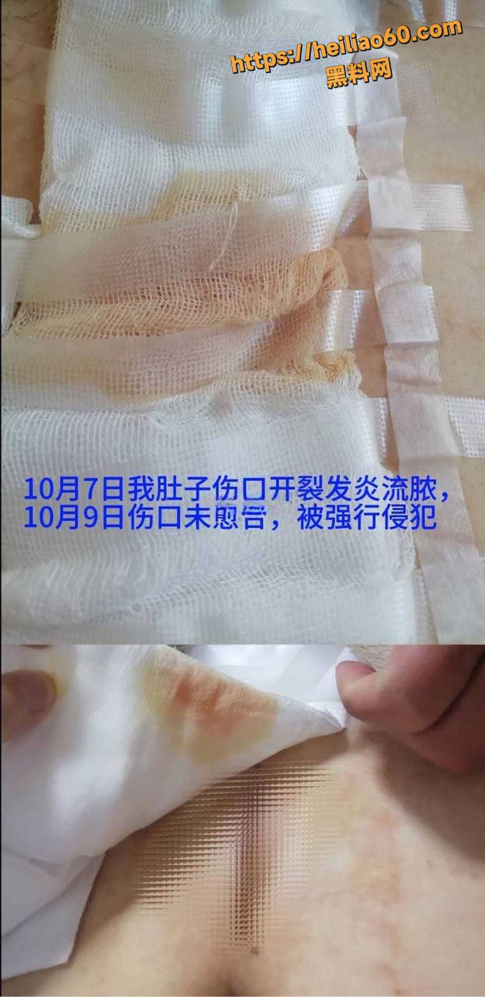 女子术后被领导强奸事件3