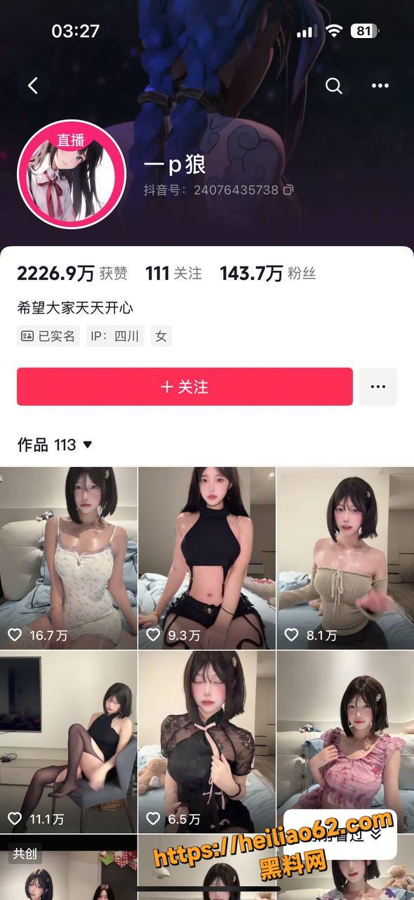 抖音擦边网红资源合集1
