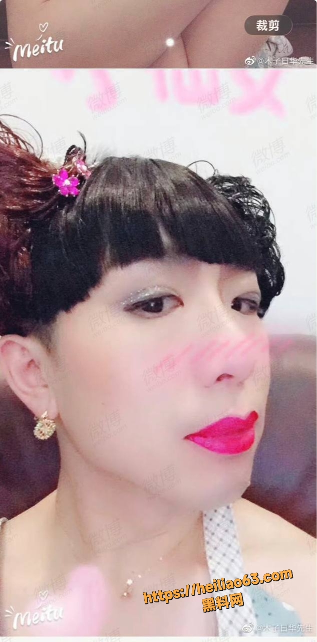 曹雪实名举报丈夫李晔家暴4