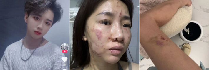 抖音热瓜 夜月神事件 原配抓到家暴男出轨 女子被家暴扔下楼视频曝光 
