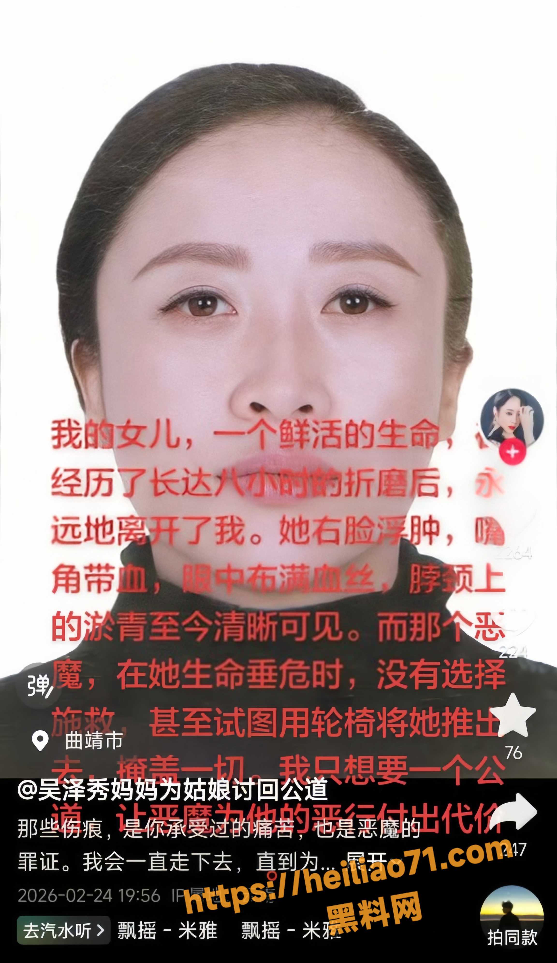虐待11