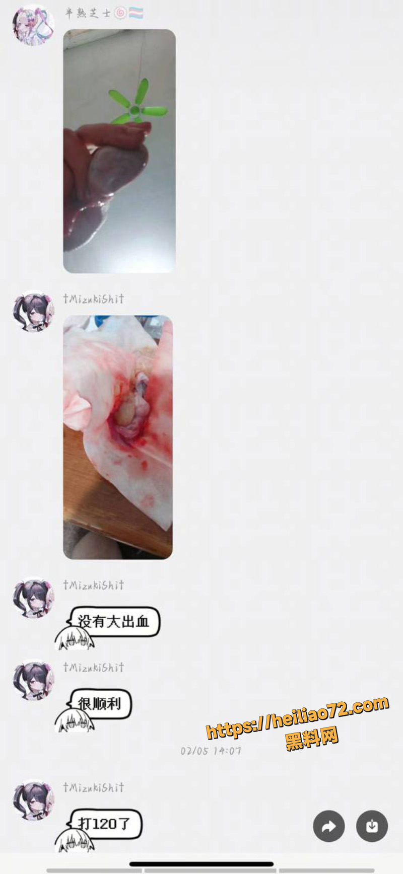 挥刀自残