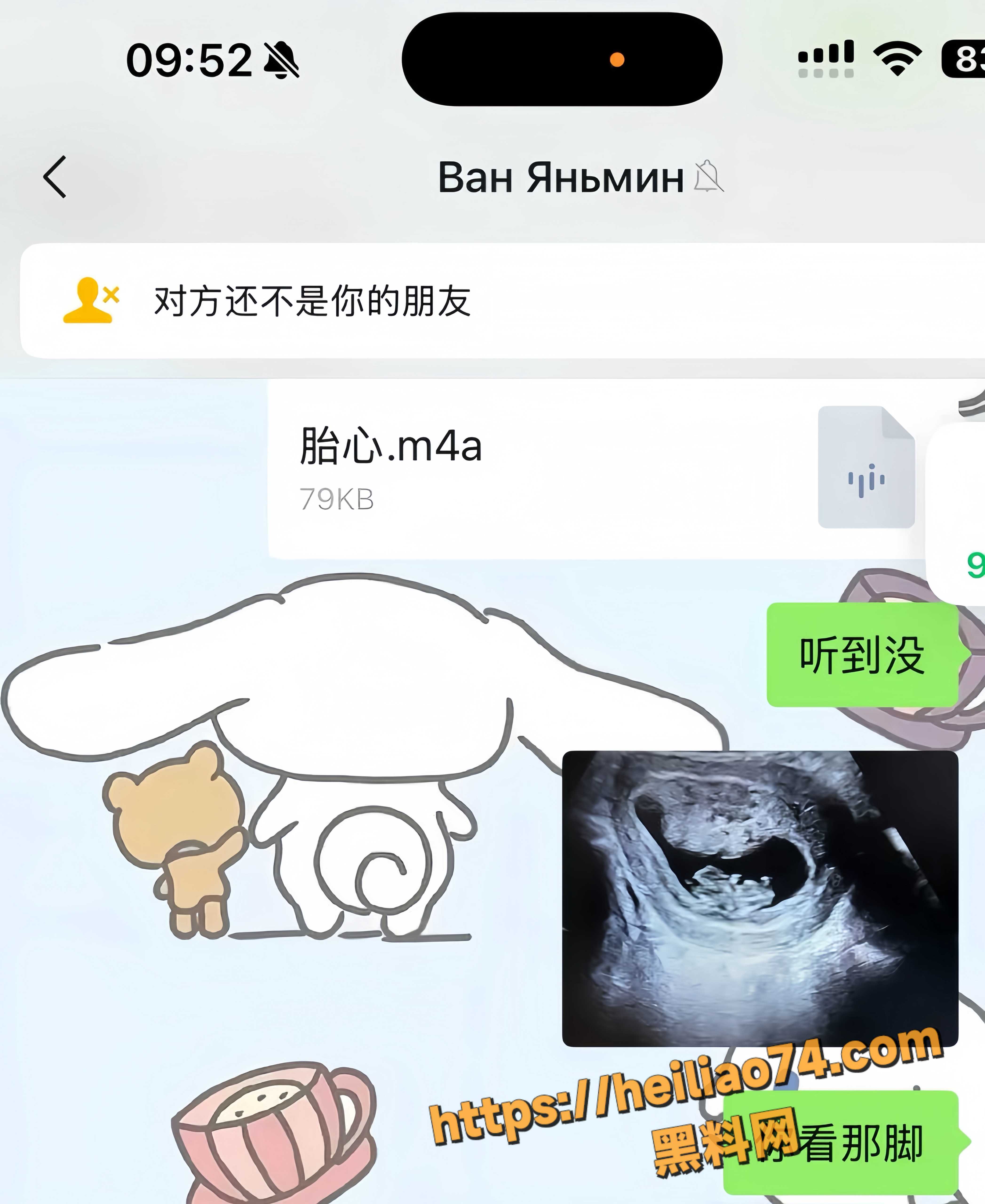王玉米逼女友打胎 3