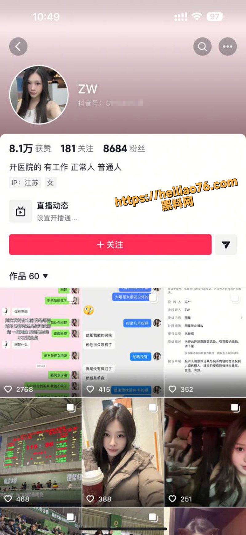 男篮郭昊文出轨