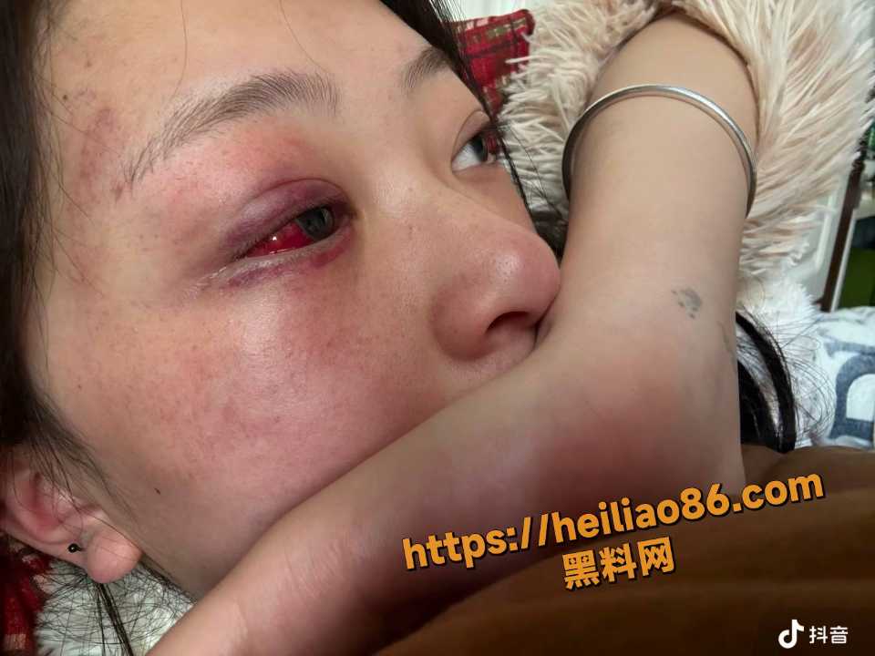 张百乔小雪家暴视频6