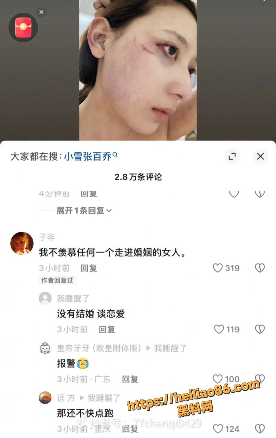 张百乔小雪婚变事件10