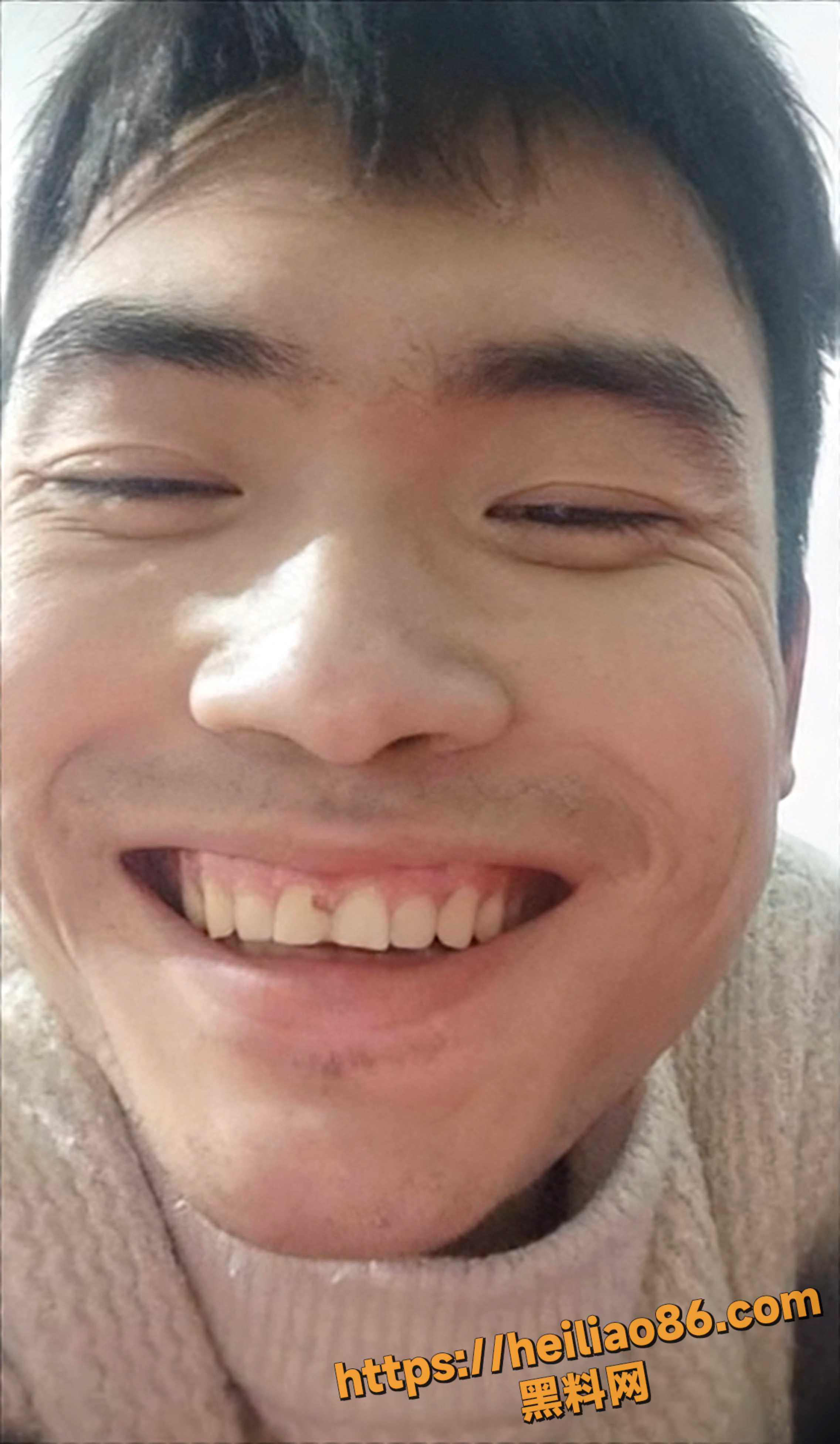残疾博主邓贱贱全裸视频3