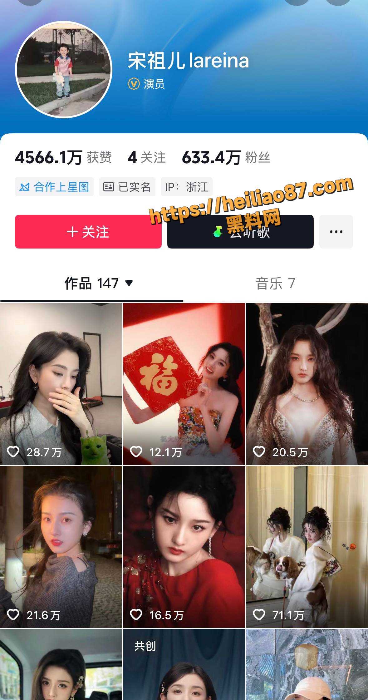 宋祖儿偷税漏税事件1
