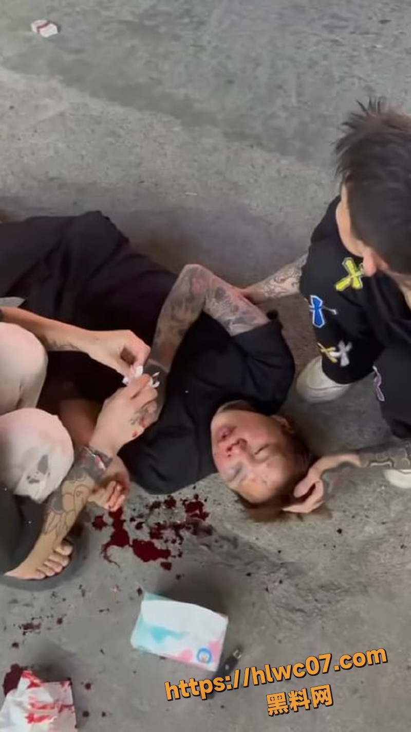 精神小伙持刀砍人事件4
