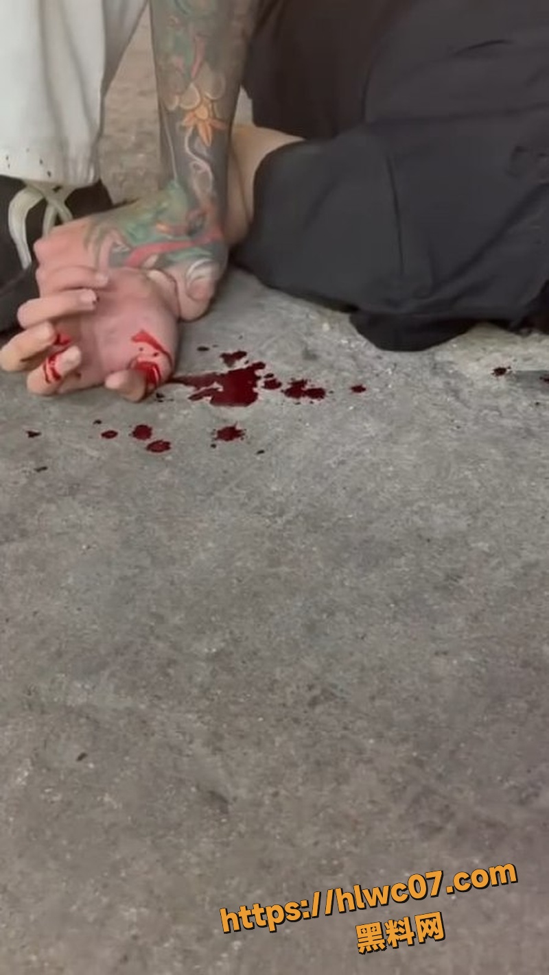 精神小伙持刀砍人事件7
