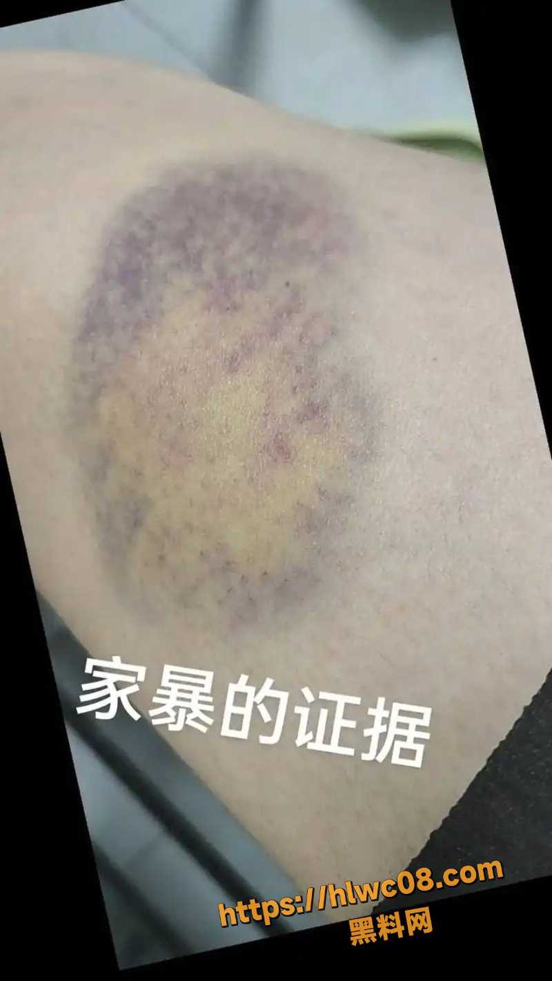 前申花球员孙吉家暴举报6