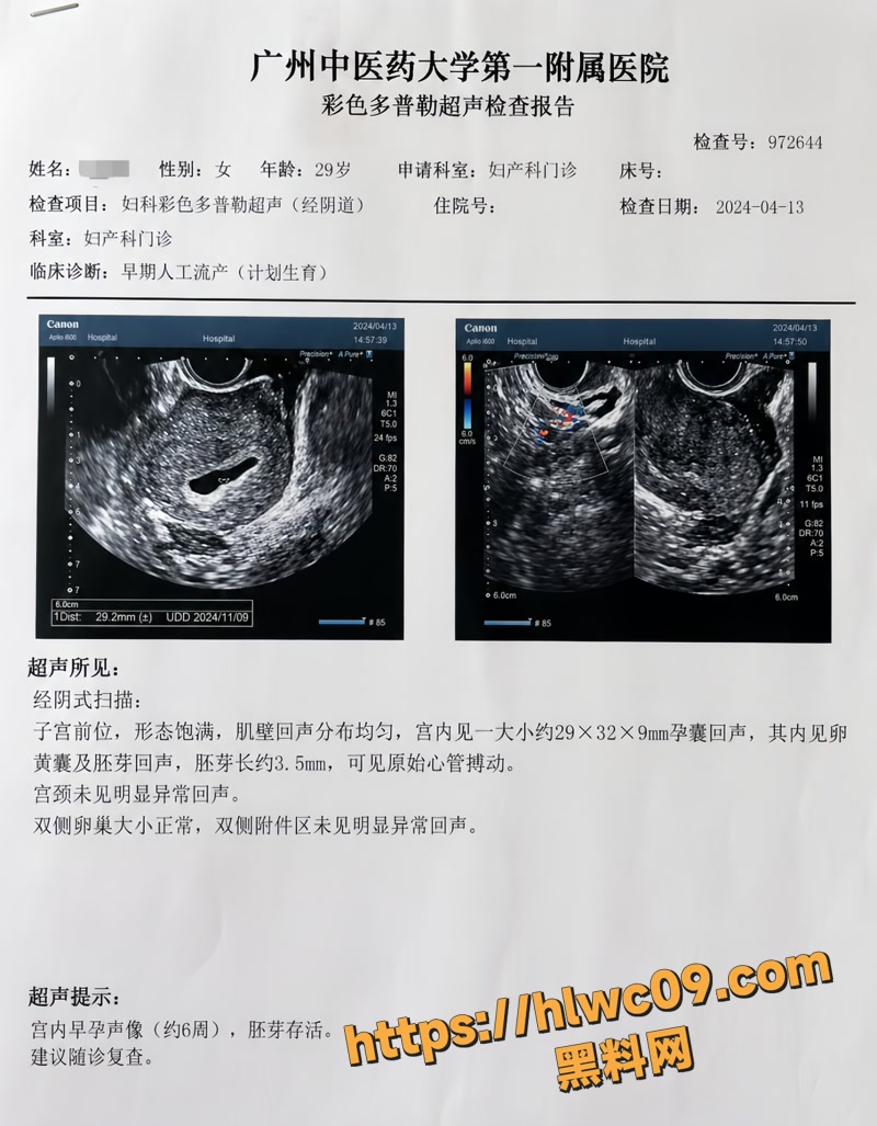 贵阳二小姐2 16wm