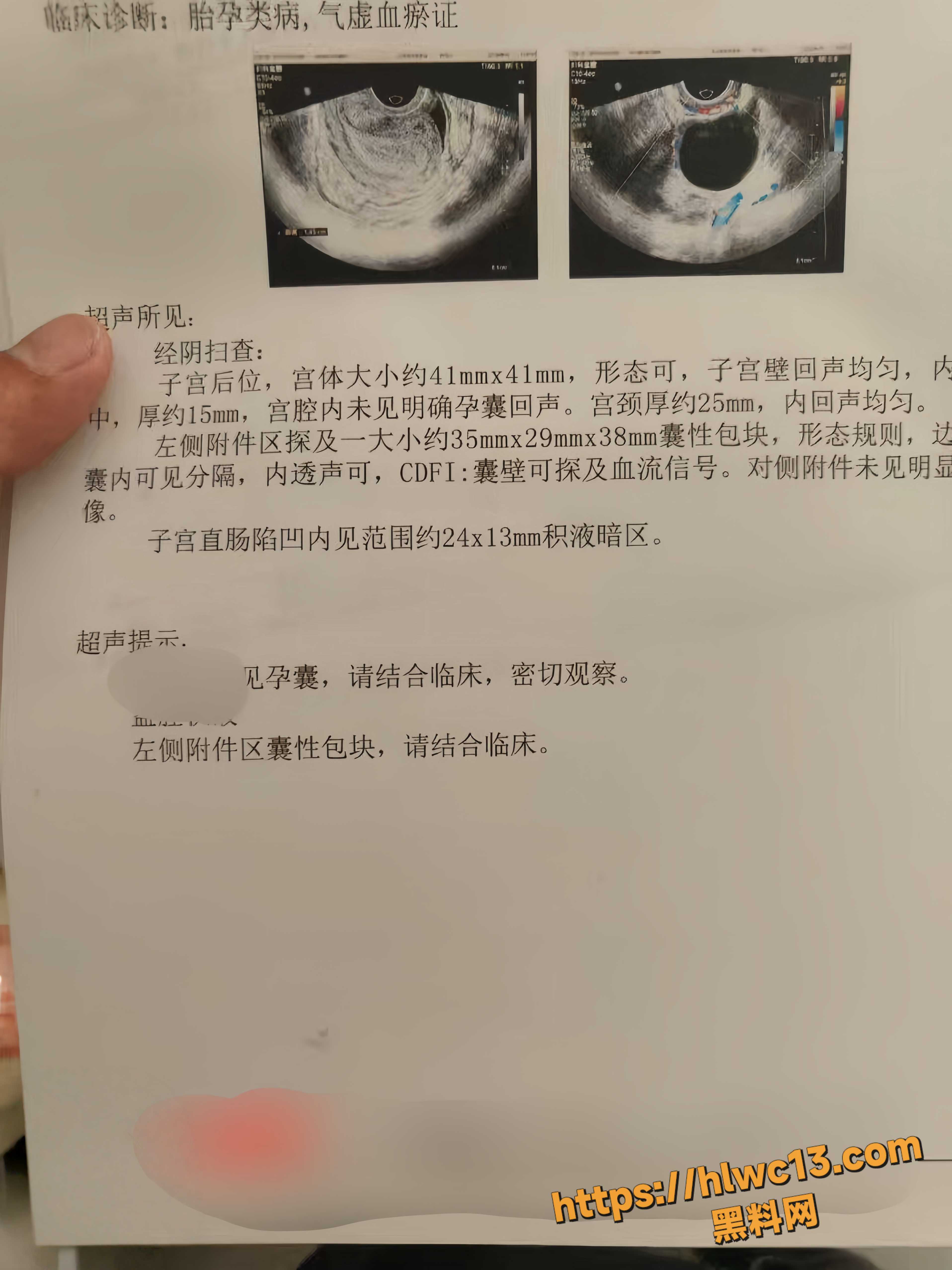 姐弟一世情3