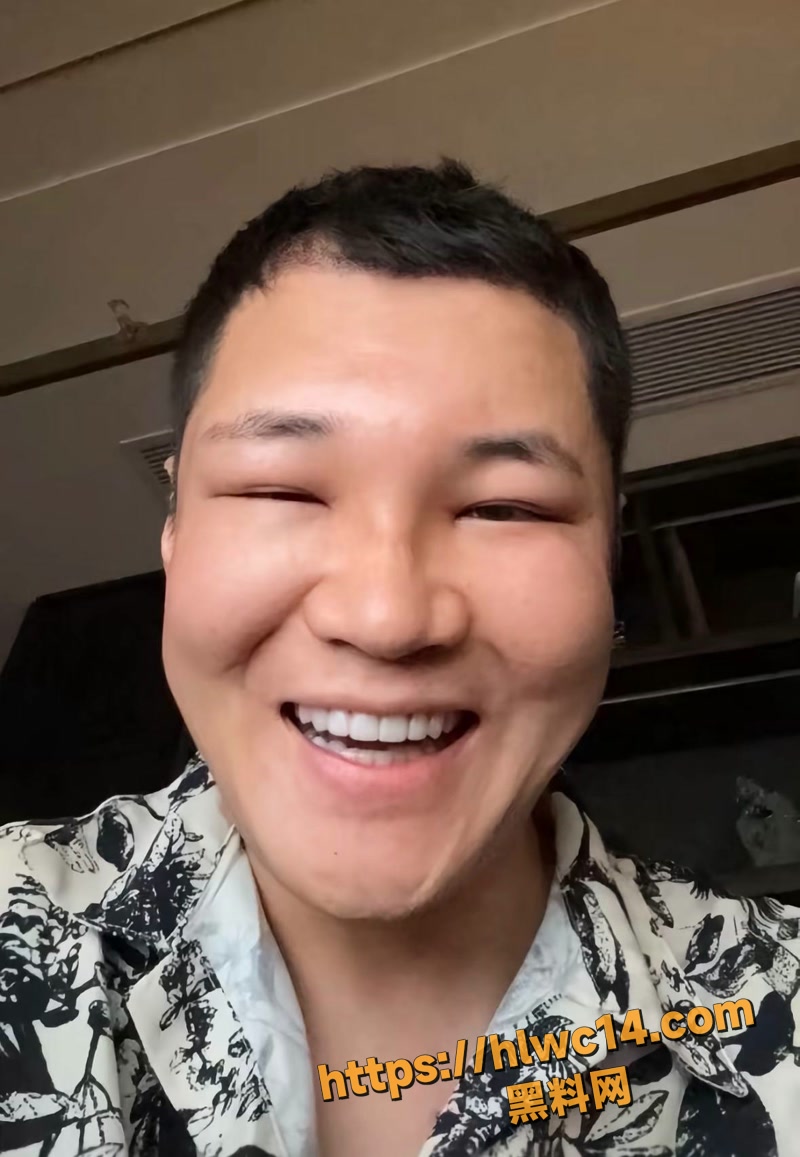 漂亮蓉整容前 6wm