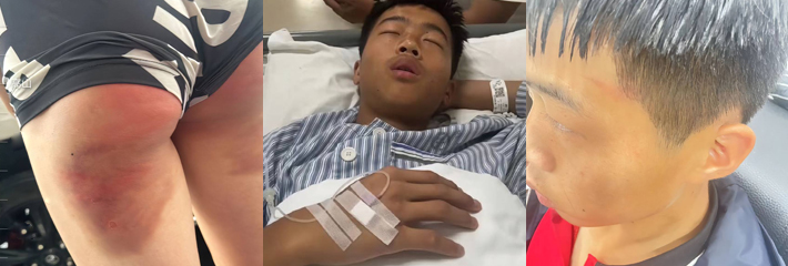 下载