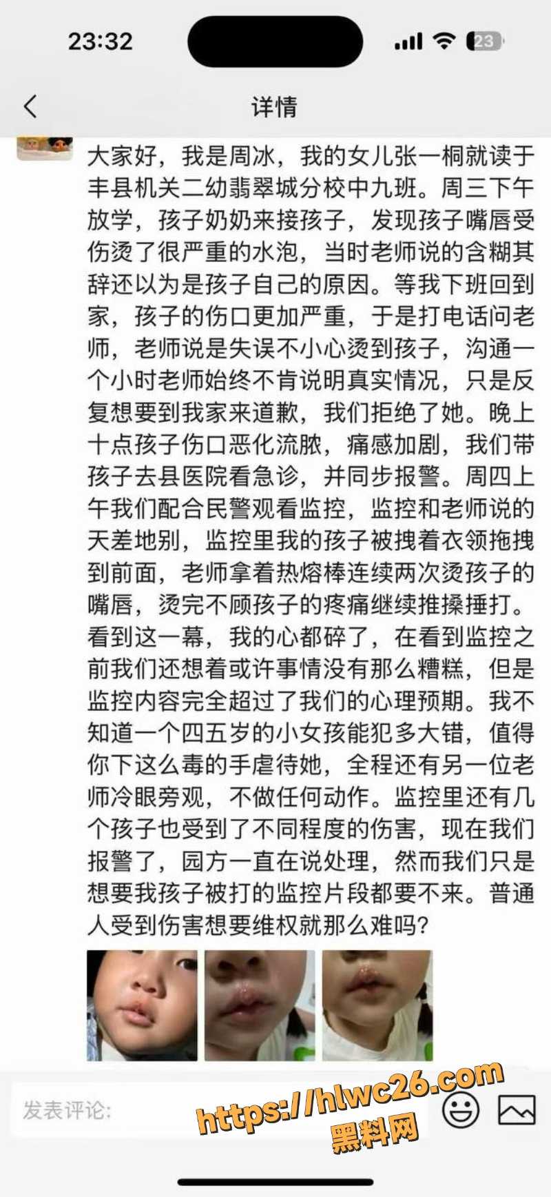 陈玉用热熔胶伤害子孩1