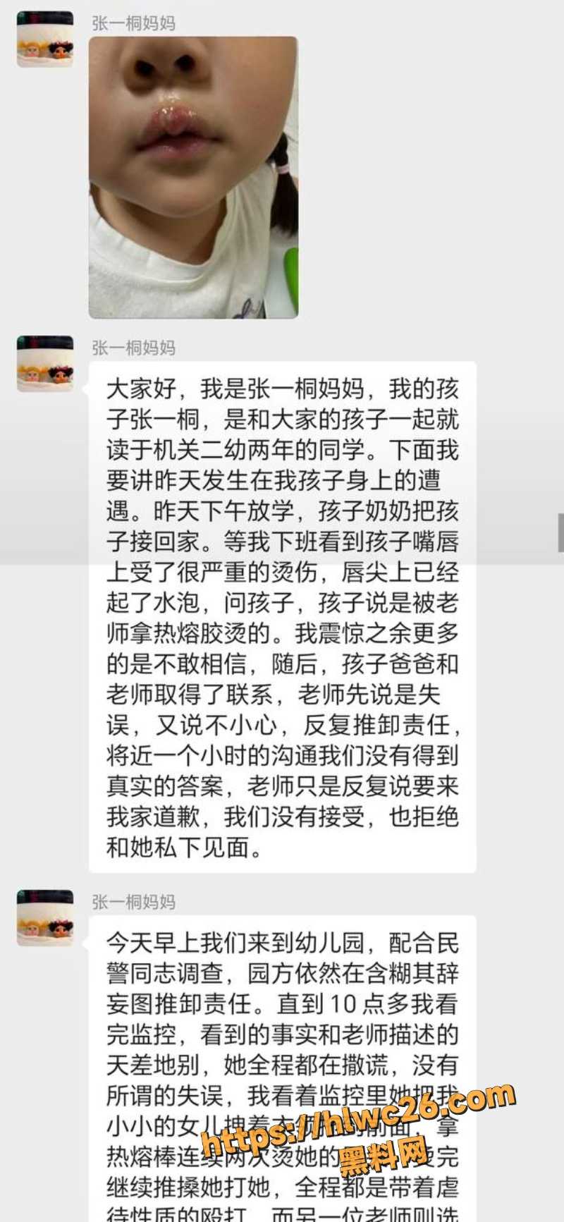 陈玉用热熔胶伤害子孩4