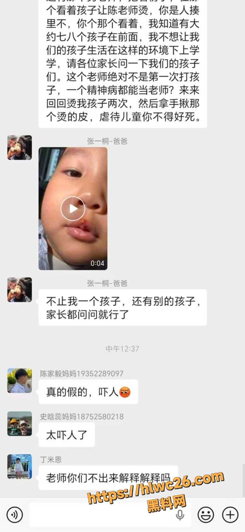 丰县机关二幼子孩烫伤事件8