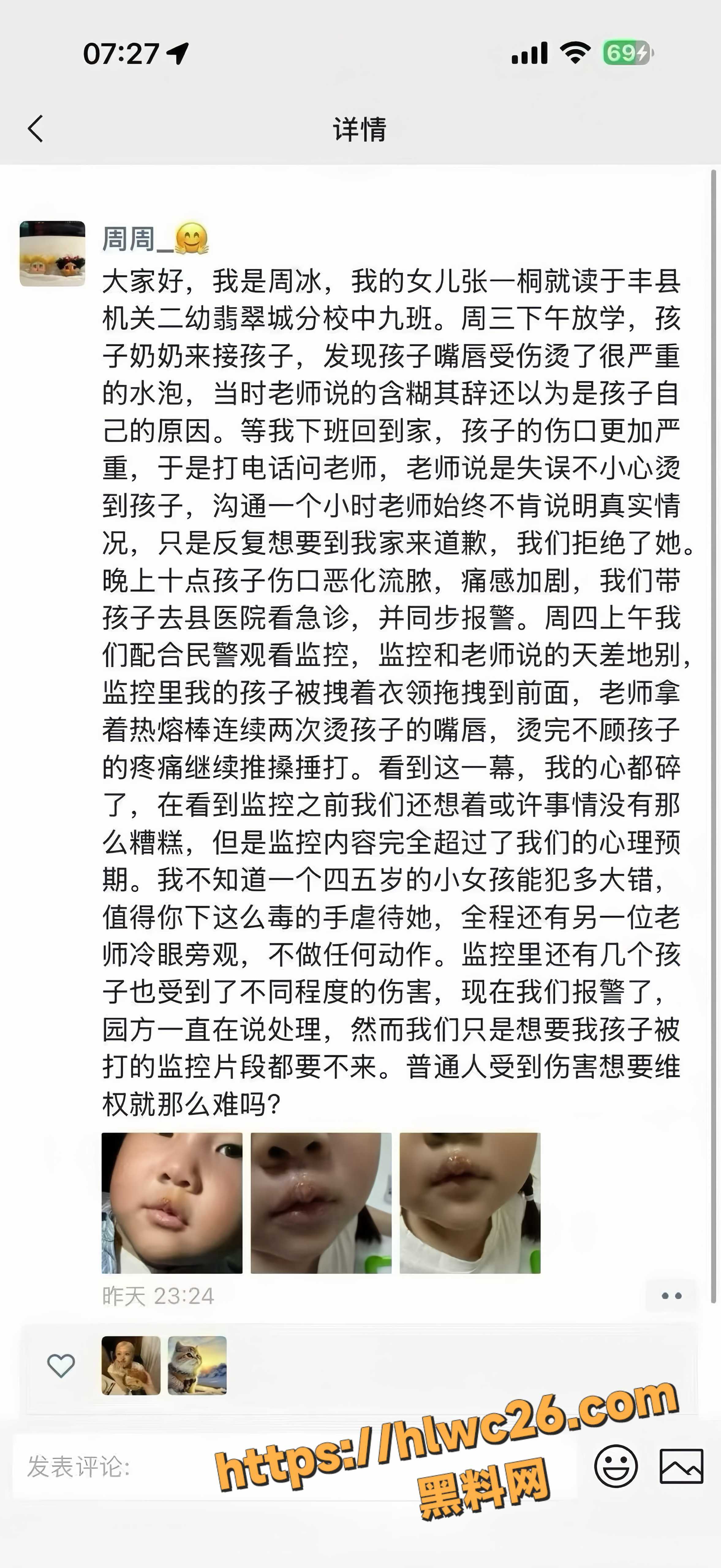 江苏徐州丰县幼儿园1