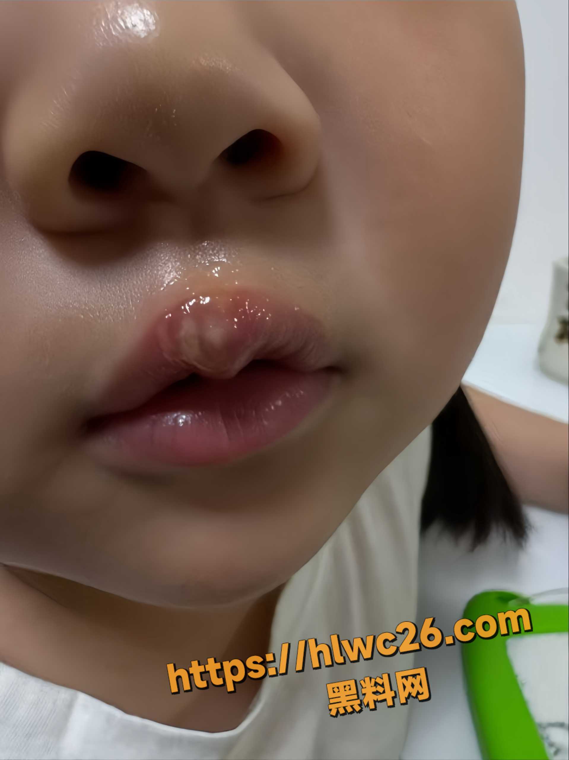 幼儿园老师烫伤女童2