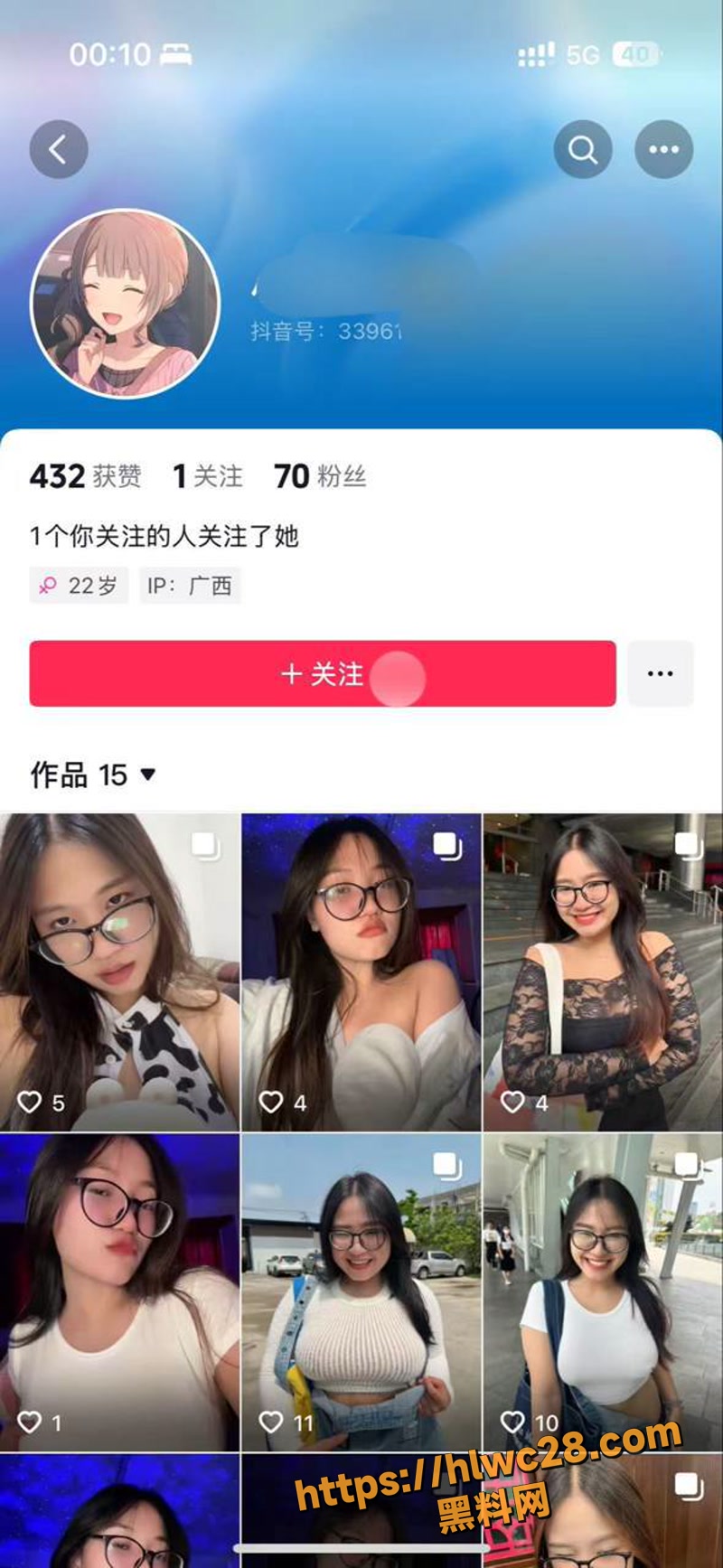 01母狗wm