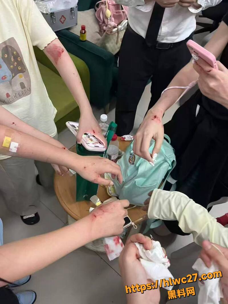 张凌赫女粉丝挤碎玻璃门9