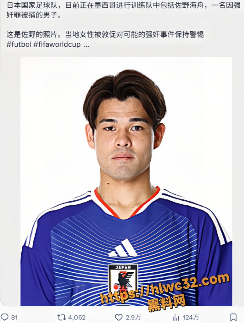 11日本国脚佐野海舟6 1wm