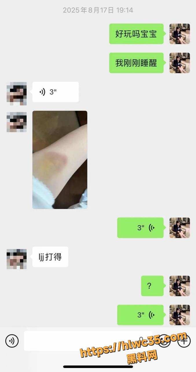 黑料曝光