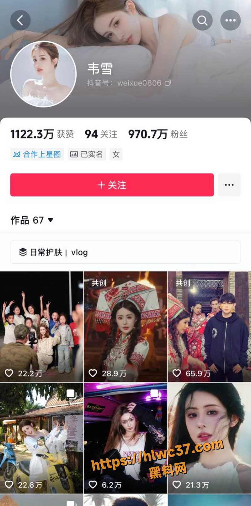 KK整容翻车被扒丑照1