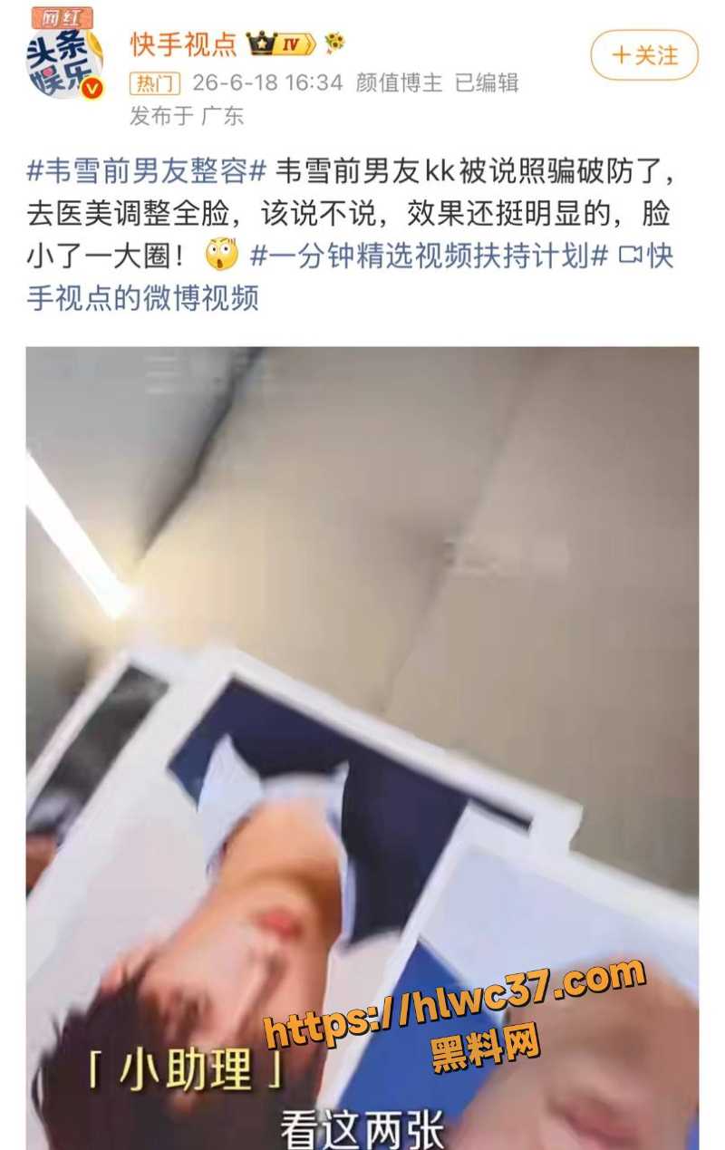 整容失败6