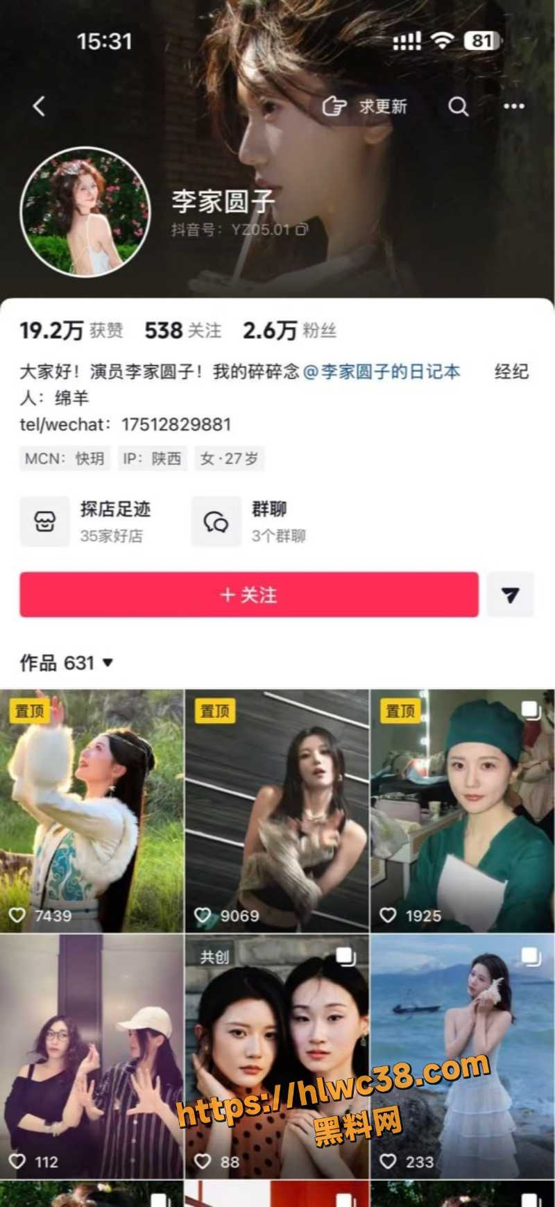 丁泳文讲述两人过往史自录视频1
