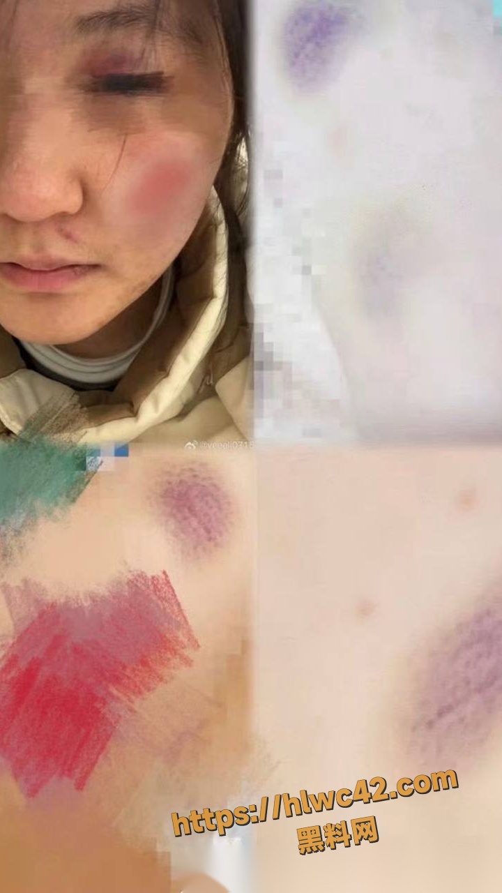 叶奕亨家暴事件