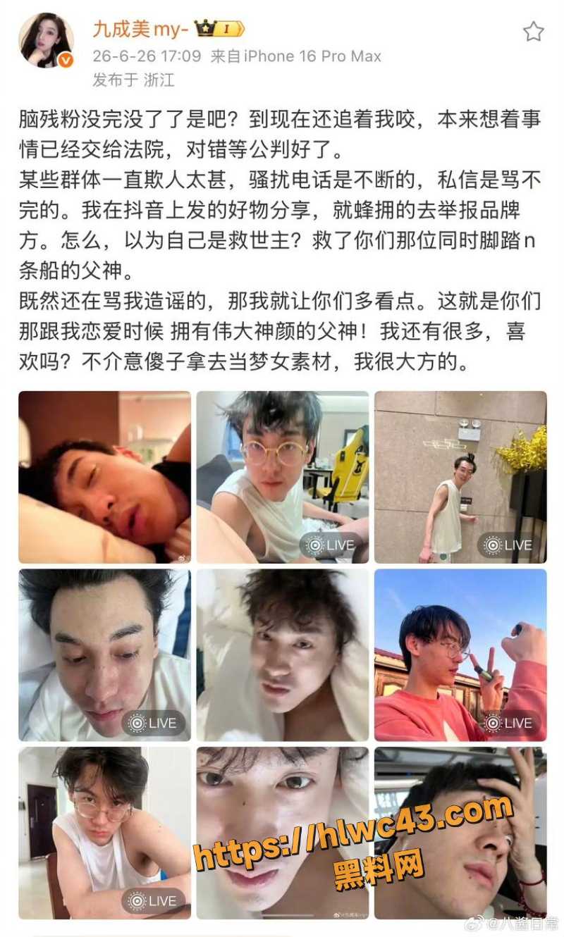 田栩宁素颜丑照曝光10