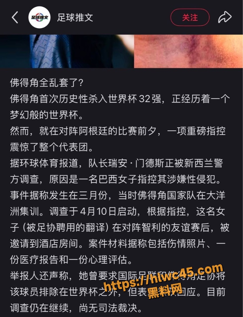 门德斯世界杯前夜爆雷3