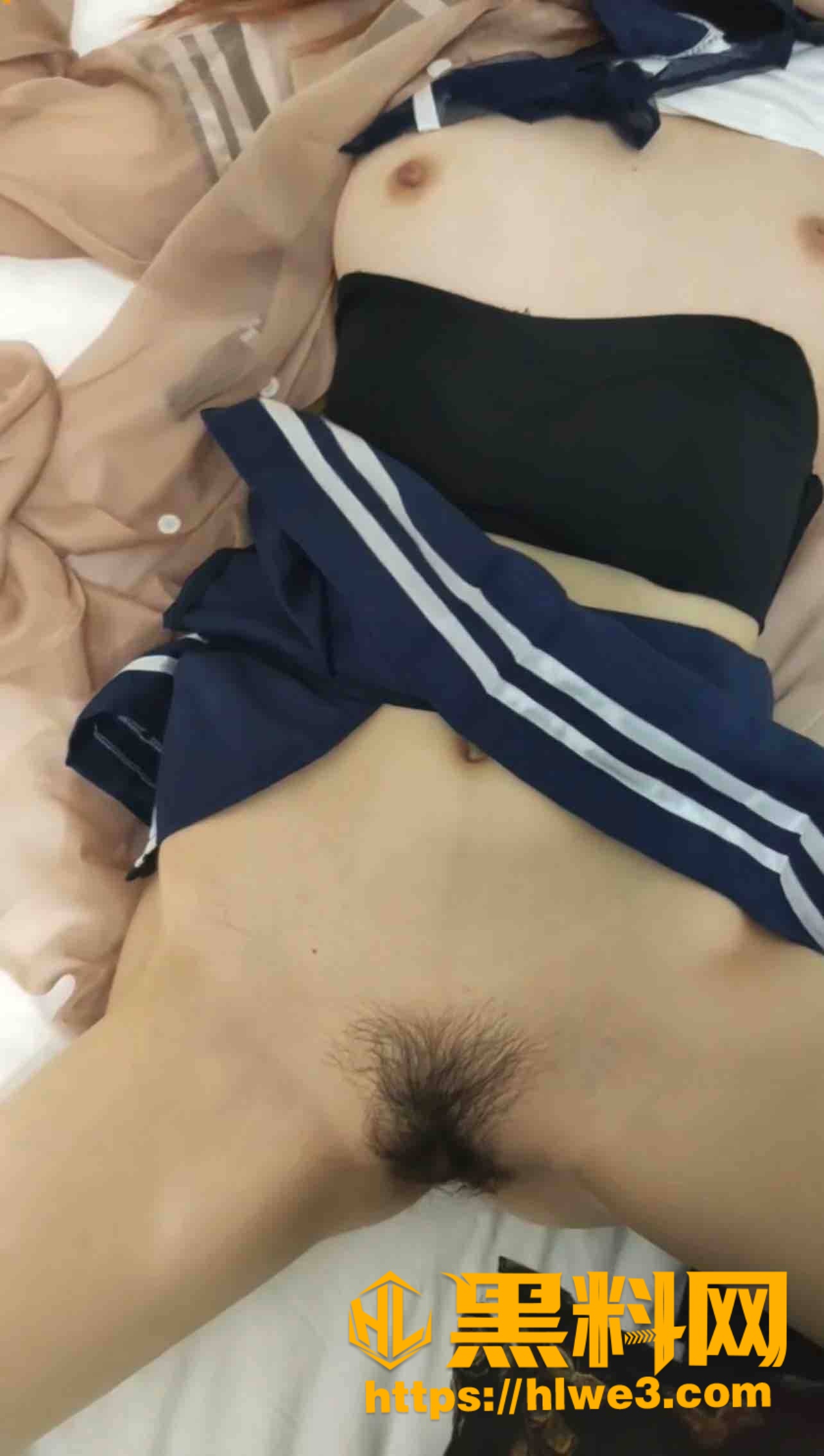 内射