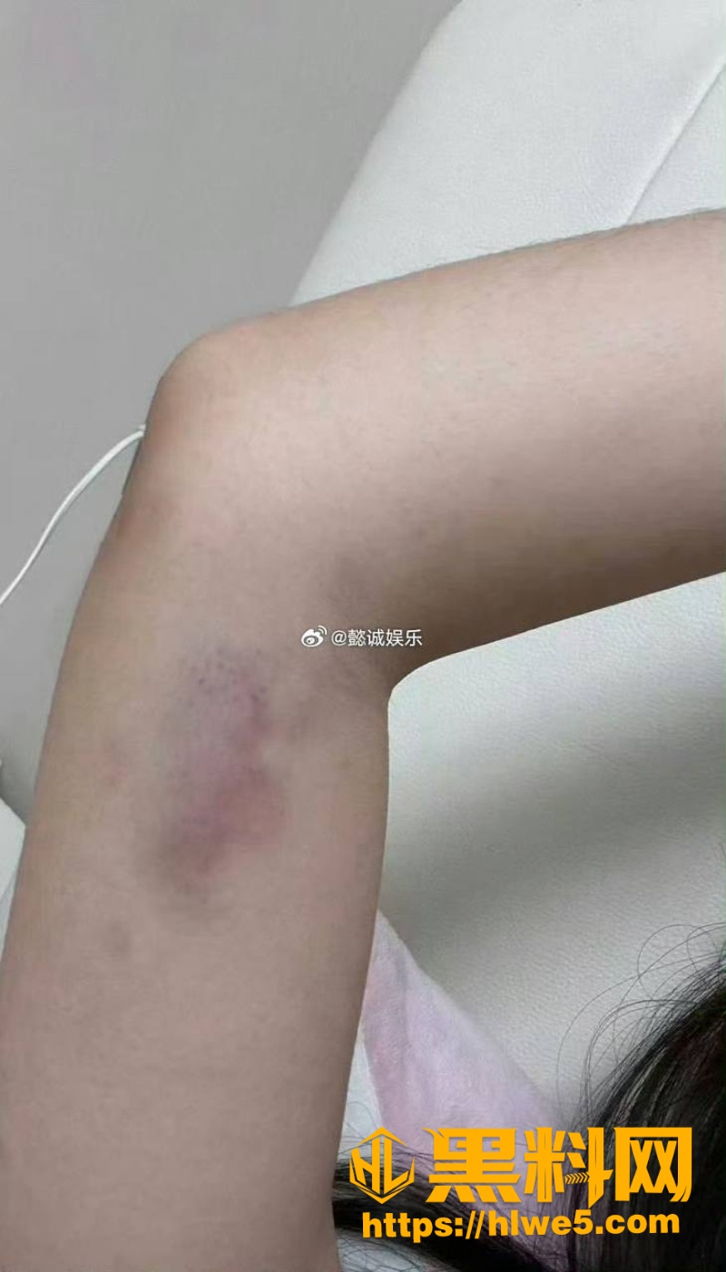 摇童出轨性爱视频2