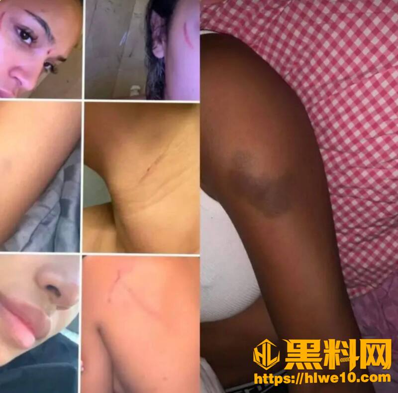 CardiB和爆帅门将31