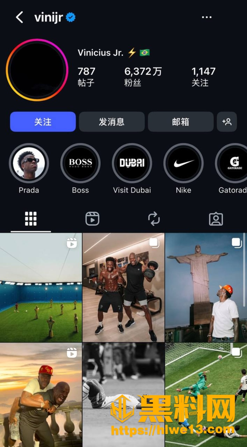维尼修斯报复性医美前后对比1
