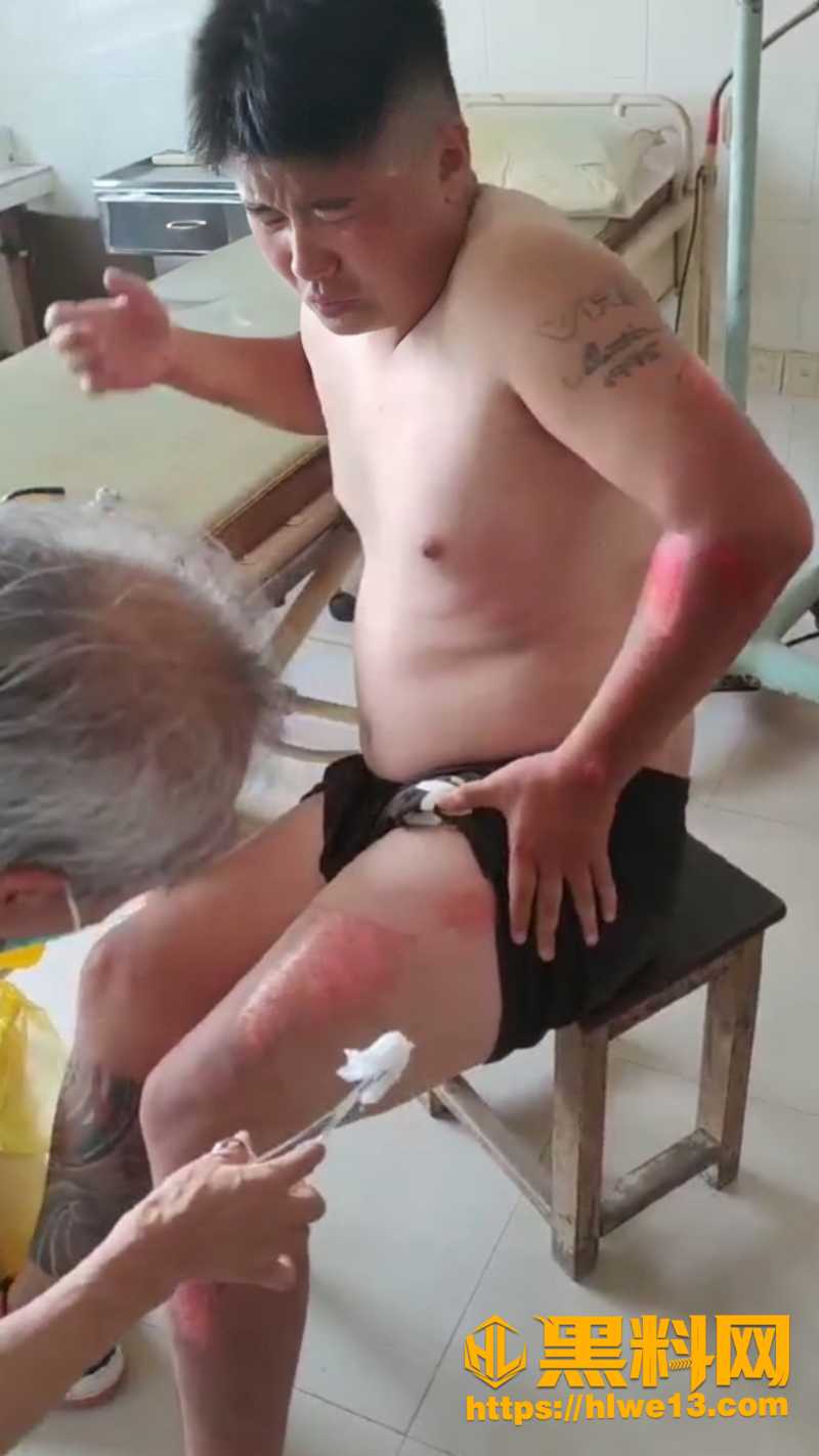 男子摔车满身伤痛5