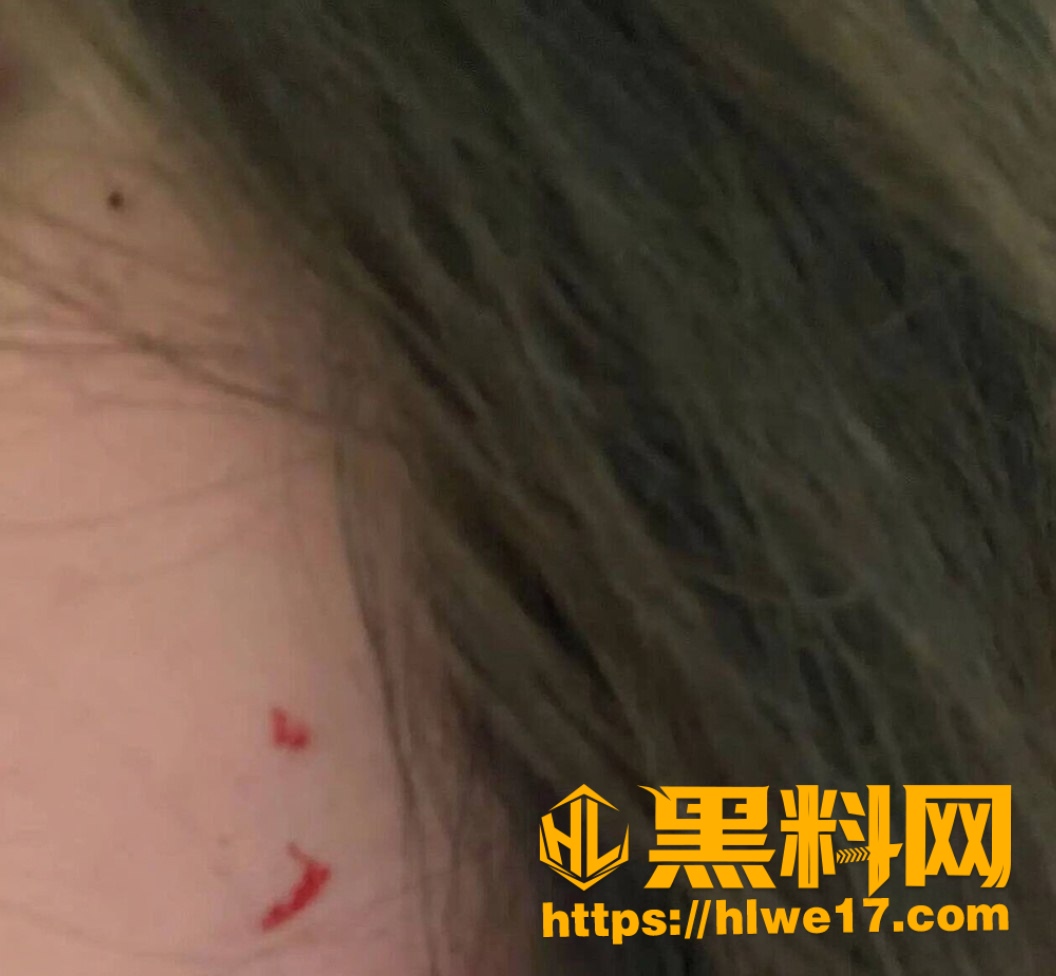  RESP家暴女友证据 1